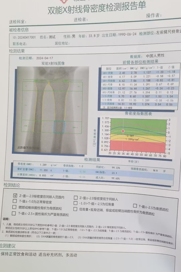 雙能X射線骨密度儀：準(zhǔn)確測量骨密度，助力骨質(zhì)疏松防治，守護(hù)骨骼健康